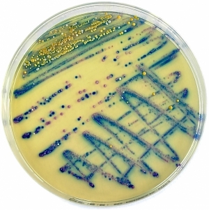 Chromatic Strepto B Agar