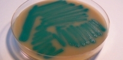 Chromogenic UTI Agar