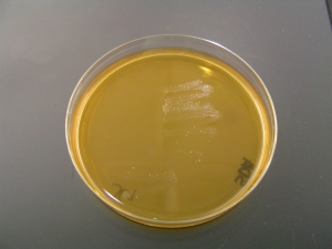 Sabouraud Dextroza Agar + CFN + GENTA