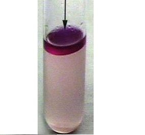 Apa Lactozo-Peptonata Andrade